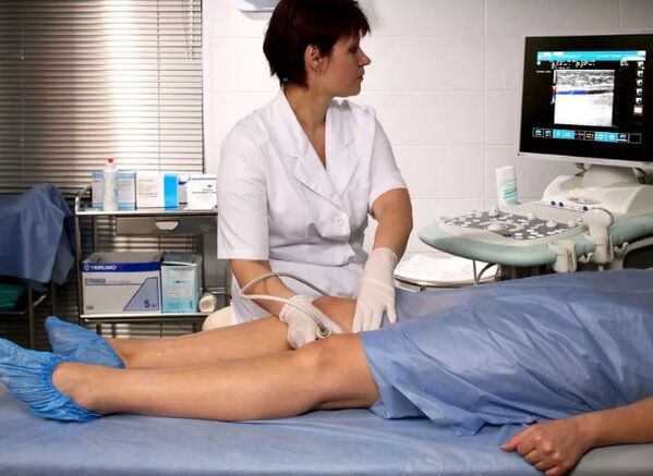 Apakšējo ekstremitāšu varikozu vēnu diagnoze